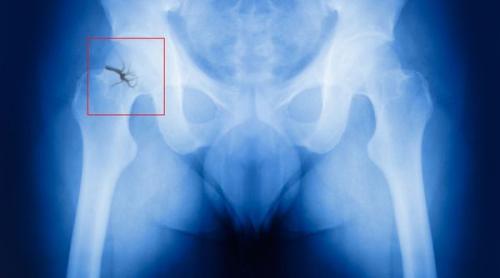 Климакс у женщин и мужчин: что нужно знать о симптомах и лечении 06