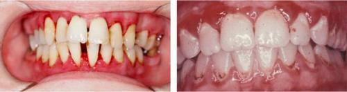 Что должна знать каждая женщина о климаксе 02 Что должна знать каждая женщина о климаксе 02