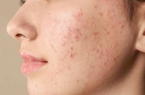 Какие продукты рекомендуется использовать для ухода за кожей лица