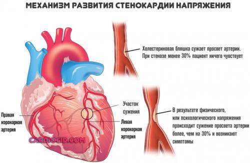 Как долго нужно принимать медикаменты для укрепления сердца. Таблетки от боли в сердце: список названий и виды препаратов, принцип действия и совместимость