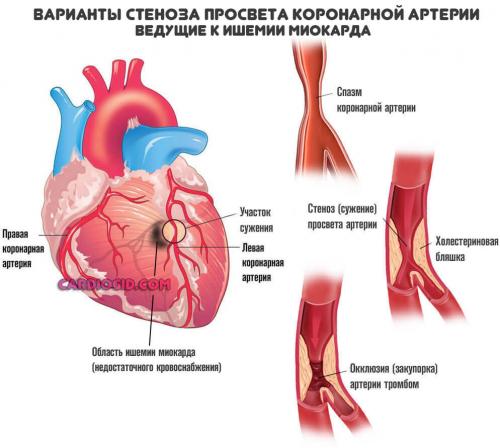 Как долго нужно принимать медикаменты для укрепления сердца. Таблетки от боли в сердце: список названий и виды препаратов, принцип действия и совместимость