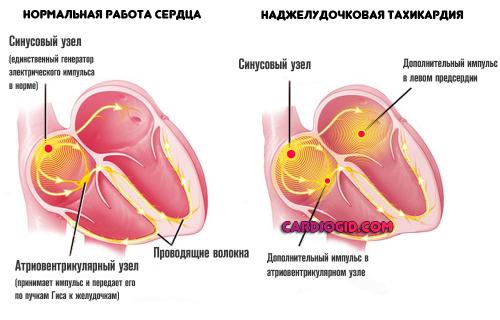 Как долго нужно принимать медикаменты для укрепления сердца. Таблетки от боли в сердце: список названий и виды препаратов, принцип действия и совместимость