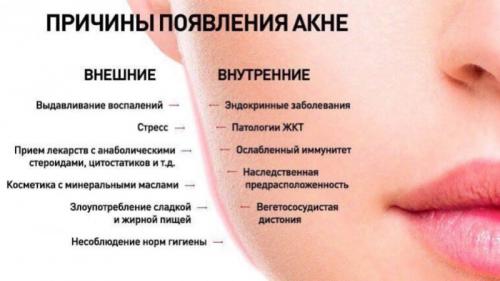 Какие факторы могут вызывать различные виды проблемной кожи. Причины возникновения