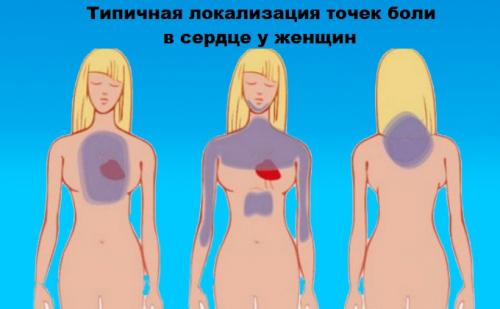 Важность регулярного физического упражнения для женского здоровья сердца 01 Важность регулярного физического упражнения для женского здоровья сердца 01