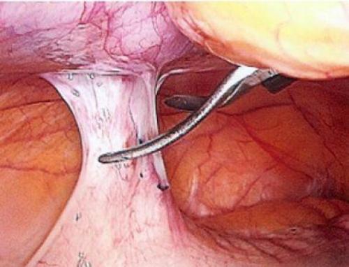 Роль правильного питания в лечении гинекологических заболеваний 02